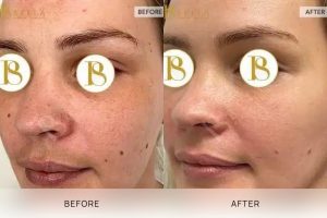 Skin Treatment 02 - 1