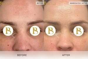 Skin Treatment 04 - 3