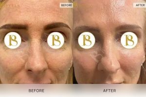 Skin Treatment 07 - 6