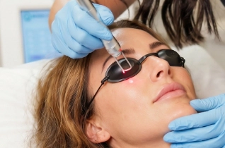 Laser Milia Removal – Bella Plastic Surgery Sydney