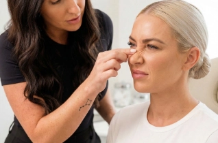 Bunny Lines – Bella Plastic Surgery Sydney