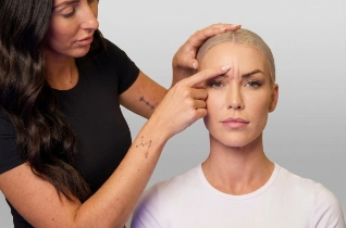 Frown lines – Bella Plastic Surgery Sydney
