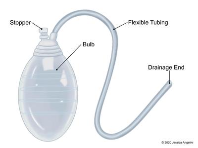 drains after breast reduction