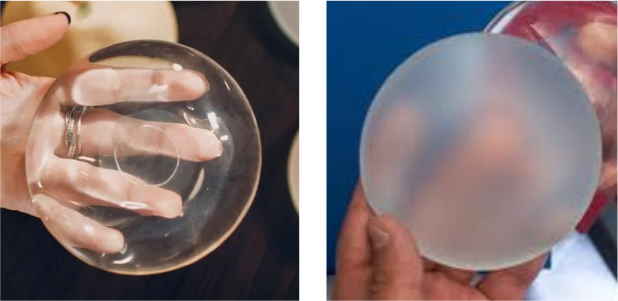 saline vs. silicone implants