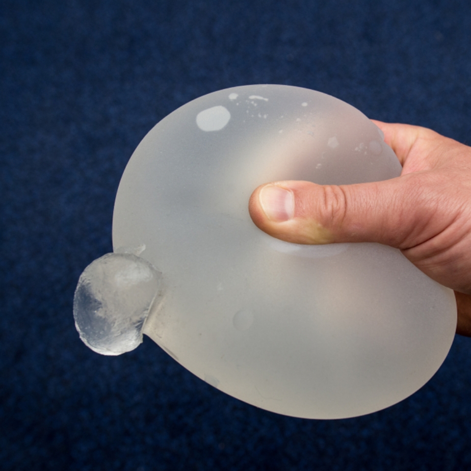 breast implant rupture