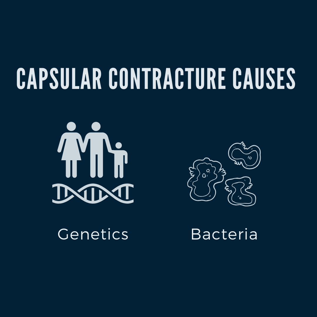 capsular contracture