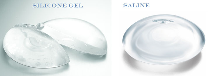 What is a breast augmentation in brisbane?