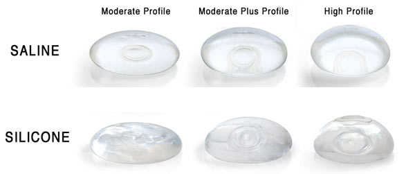 silicone-vs-saline-breast-implant-2