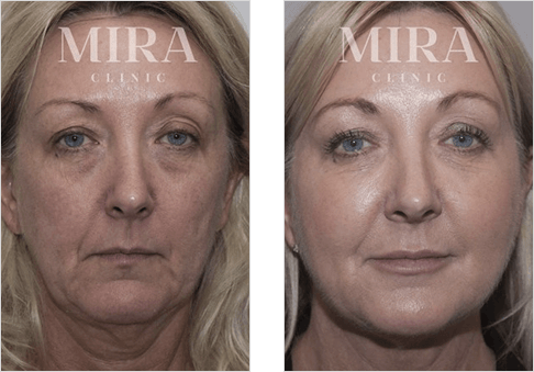 Clinic - mira clinic - 8