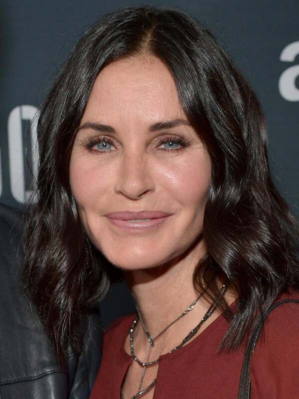 Courtney cox before photo 1 - mira clinic - 2