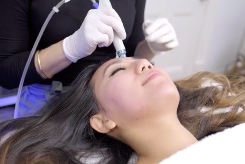 Hydrafacial feat image - mira clinic - 3