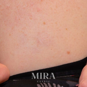 Ltr after img9 - mira clinic - 6