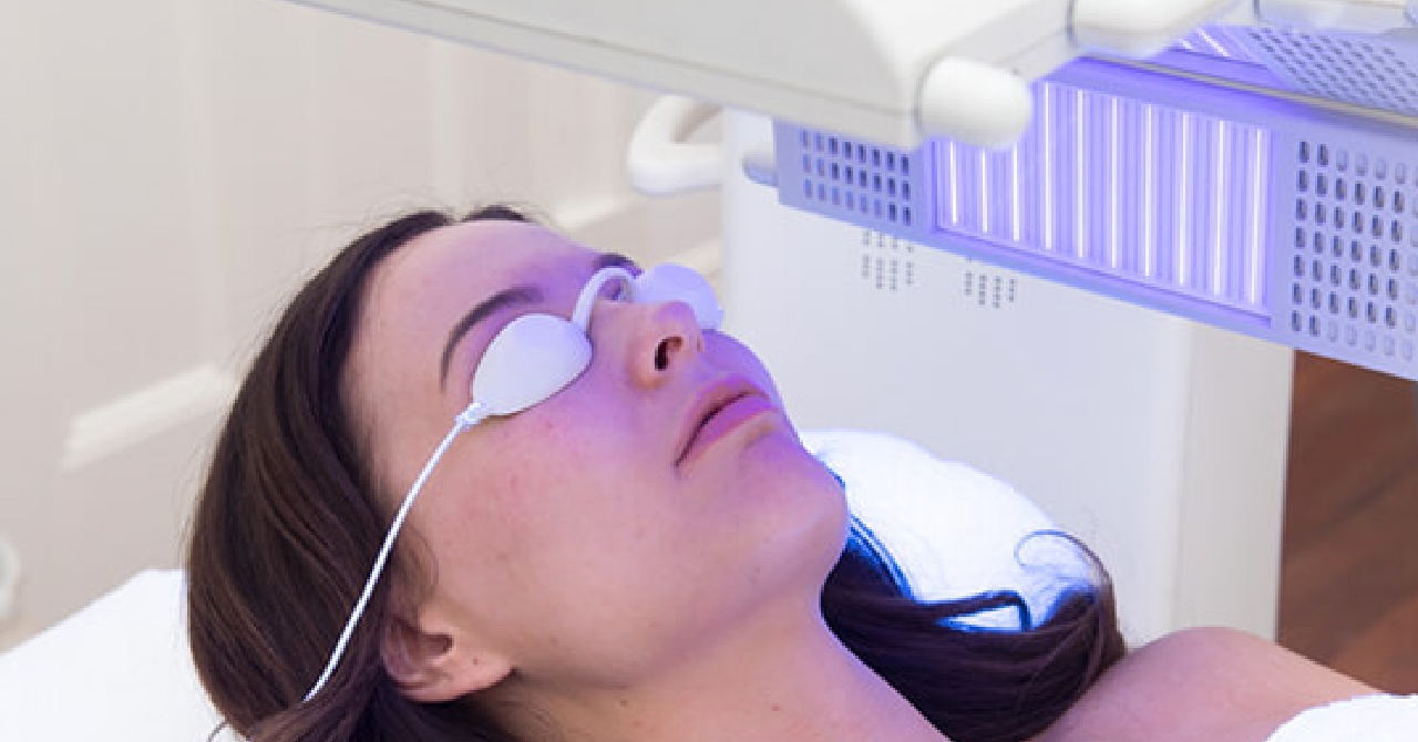 Fitzpatrick skin type, blog 1