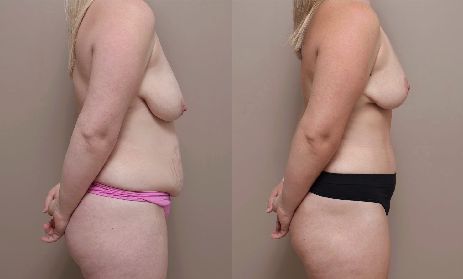 Screenshot 2026 04 23 at 1.10.39 PM Gallery Breast Reduction - 3